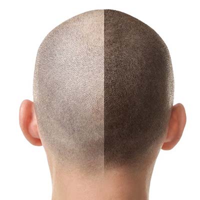 Van Cleave Aesthetics Permanent Specialty Services Scalp Micropigmentation